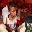 أطفال النازحين في مخيم الفردوس بعدن.. سوء تغذية ورعاية طبية متواصلة